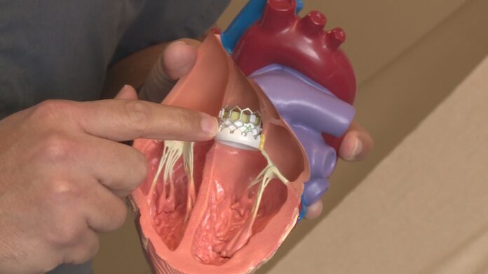 aort kapak değişimi